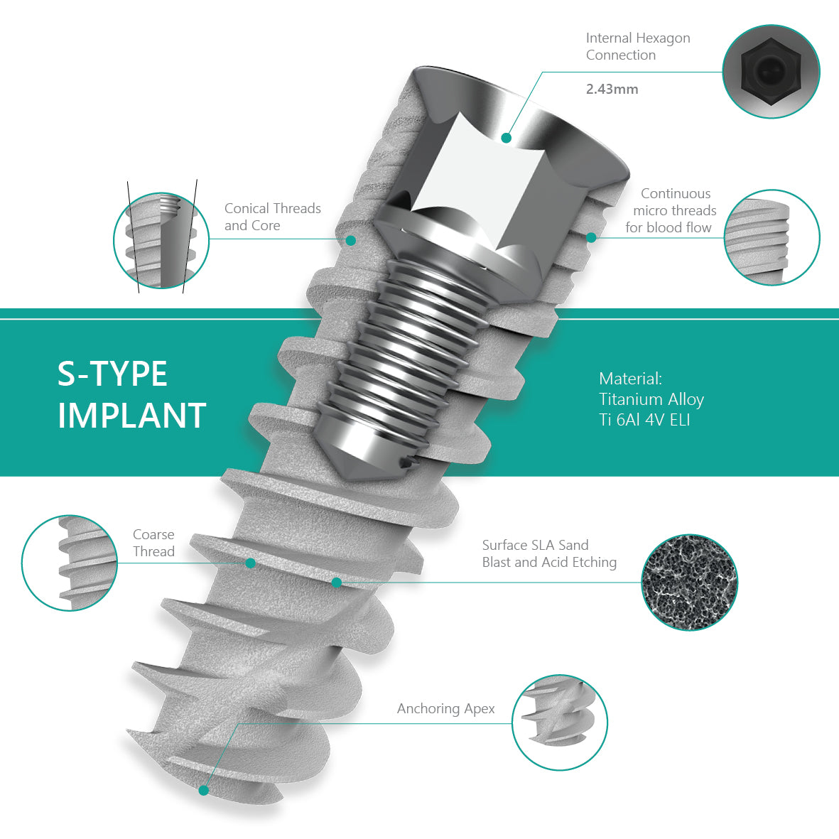 S-Type self-drilling spiral implant, Internal Hex 2.43, SLA surface features