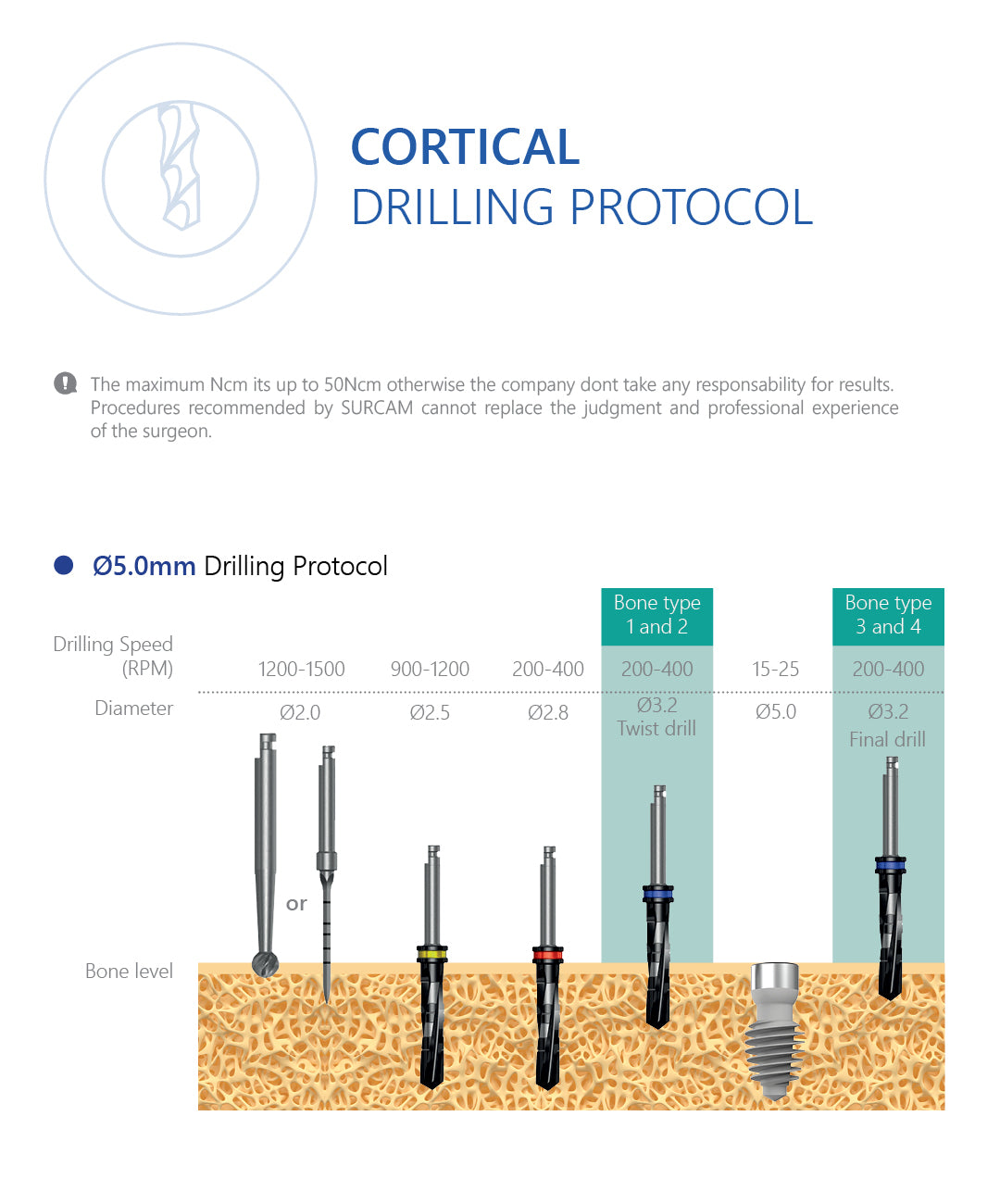 SC-Type Cortical Dental Implant