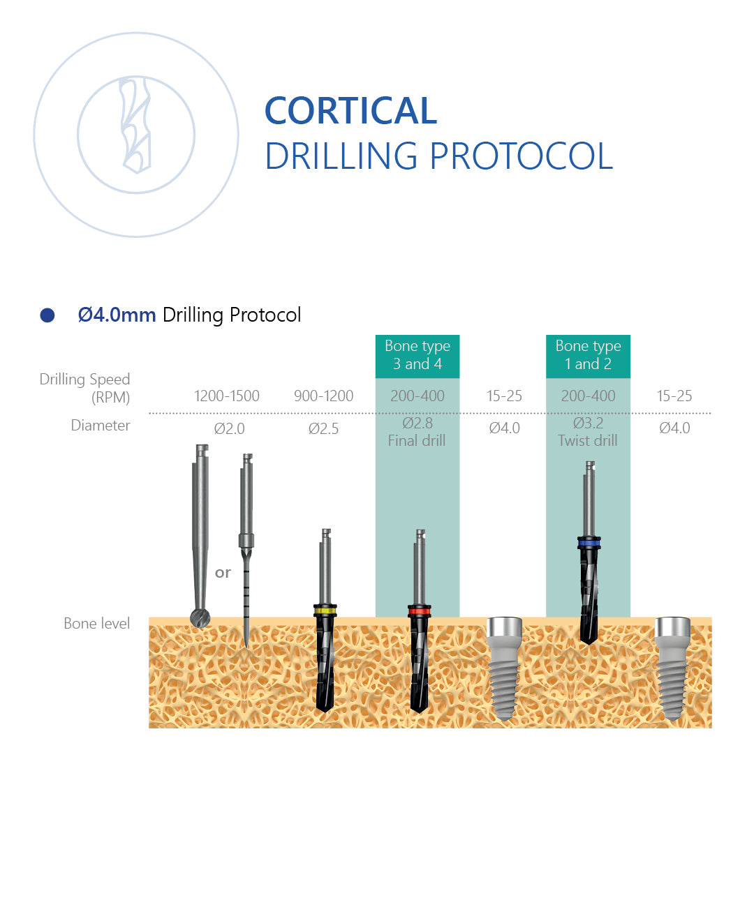 SC-Type Cortical Dental Implant