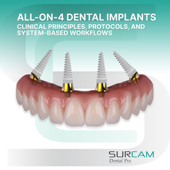 Implantes dentales All-on-4: principios clínicos, protocolos y flujos de trabajo basados ​​en sistemas