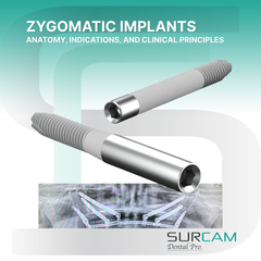 Implantes cigomáticos: anatomía, indicaciones y principios clínicos