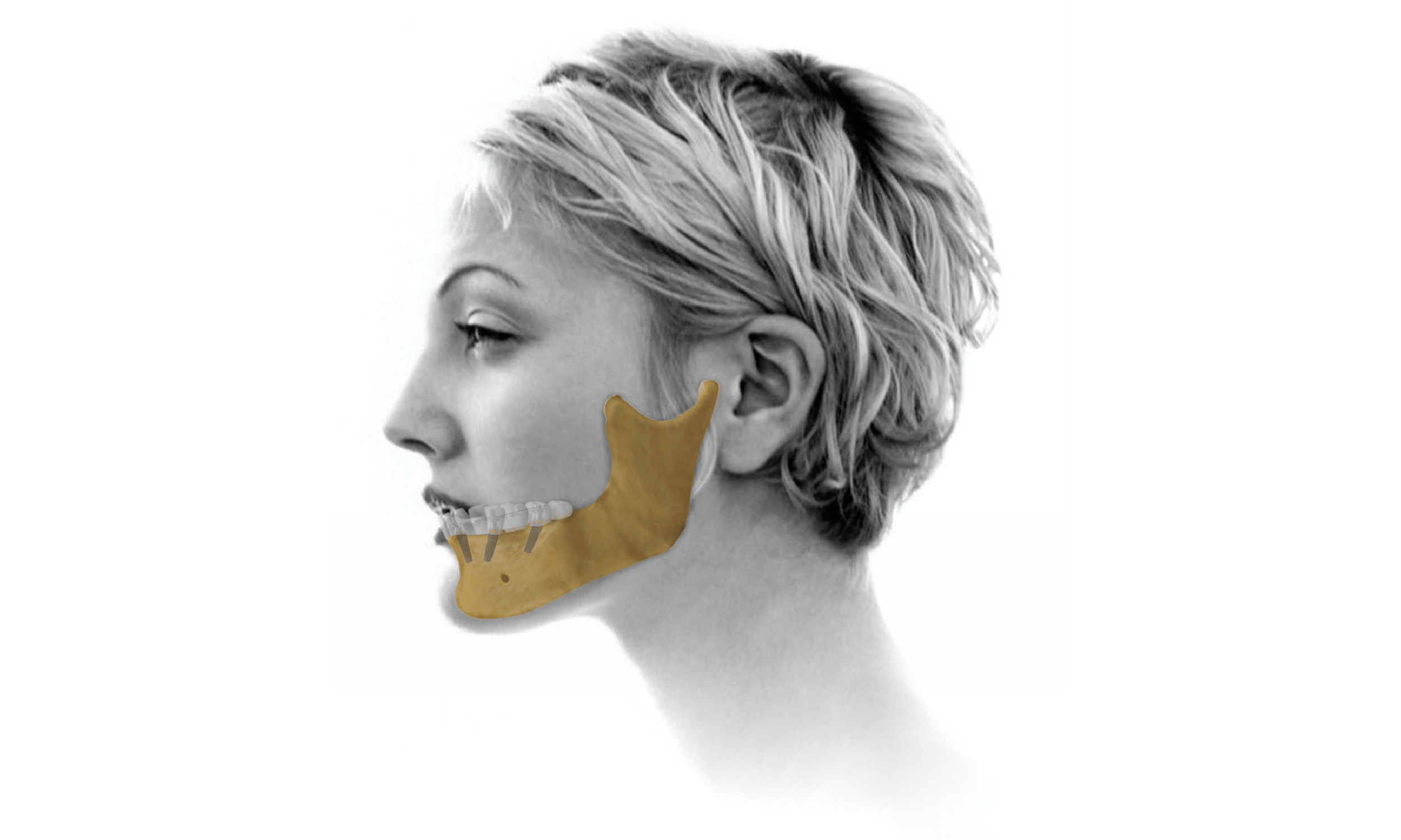 Why Clinicians Choose SURCAM