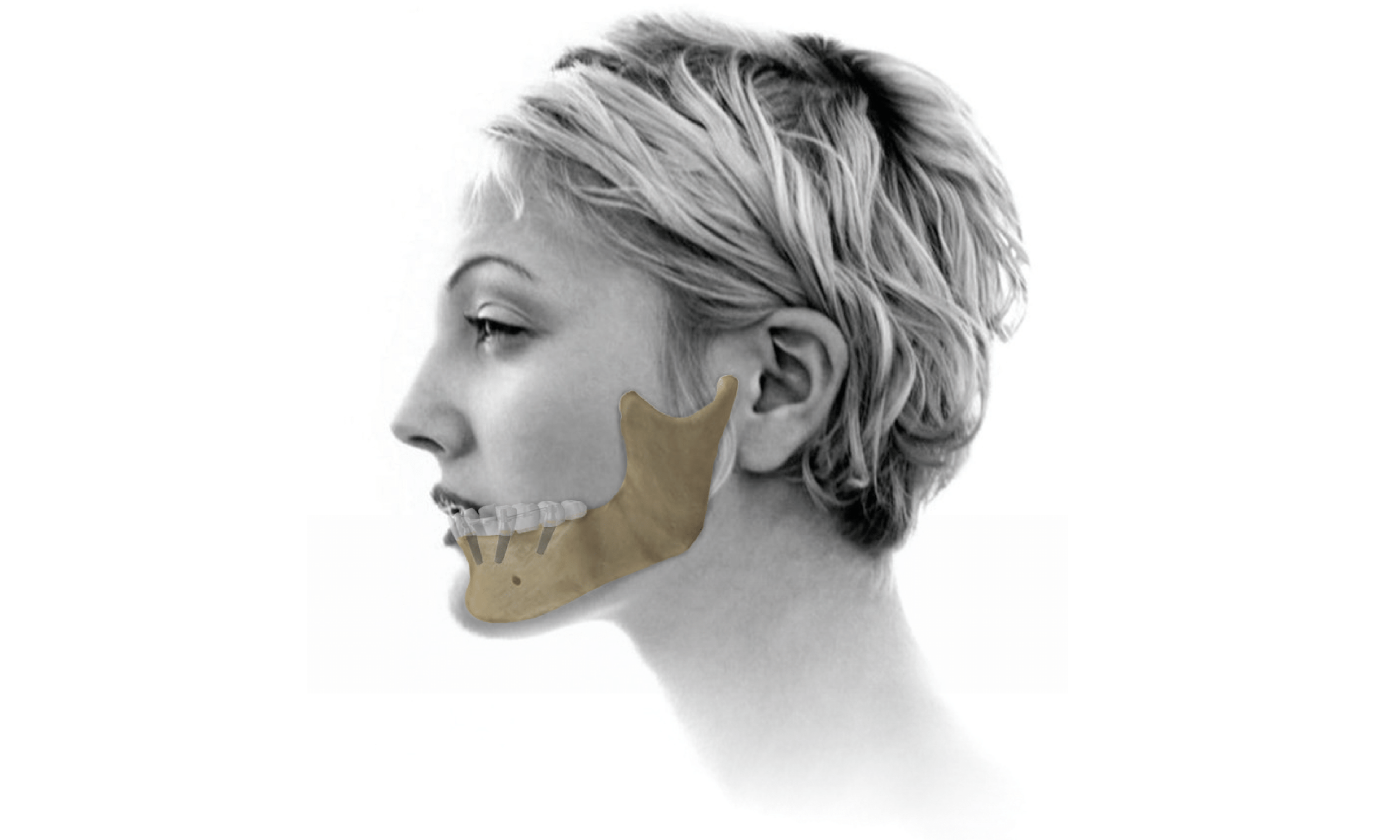 Shop Surgical Tools and Transfers Trusted by Dental Professionals