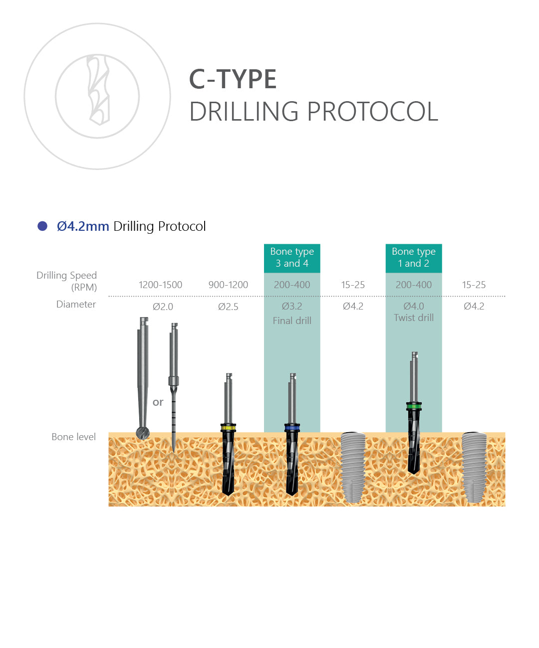 C-Type Implant Drilling Protocol 4.2