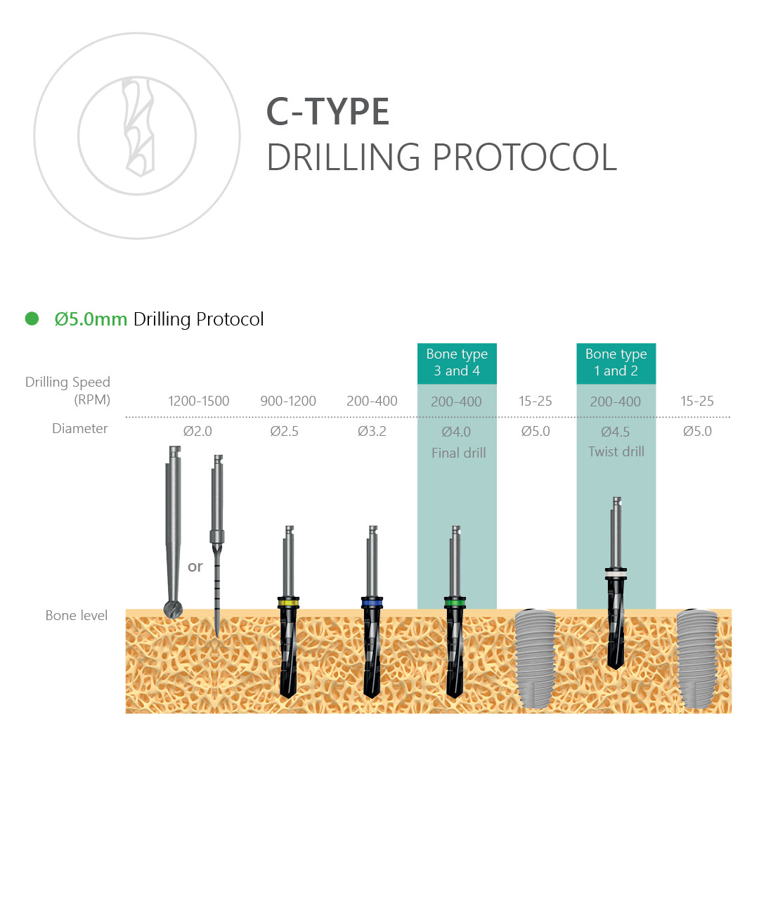 C-Type Implant Drilling Protocol 5.0