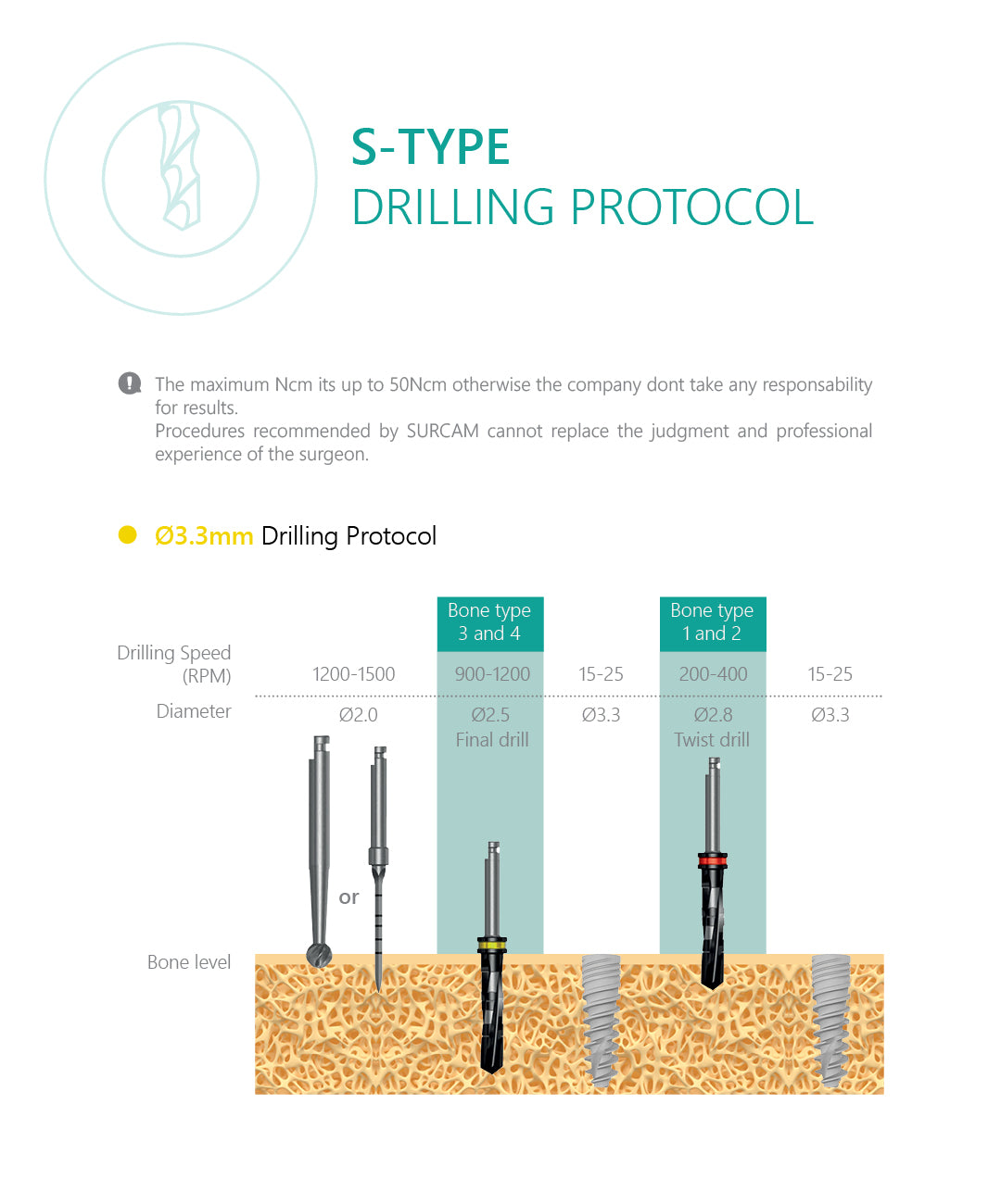 S-Type implant drilling protocol 3.3