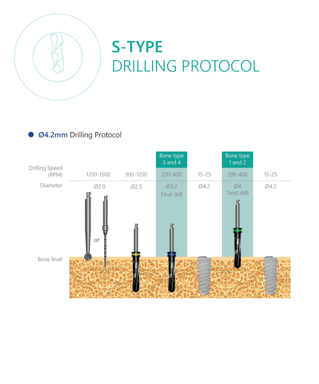 S-Type implant drilling protocol 4.2