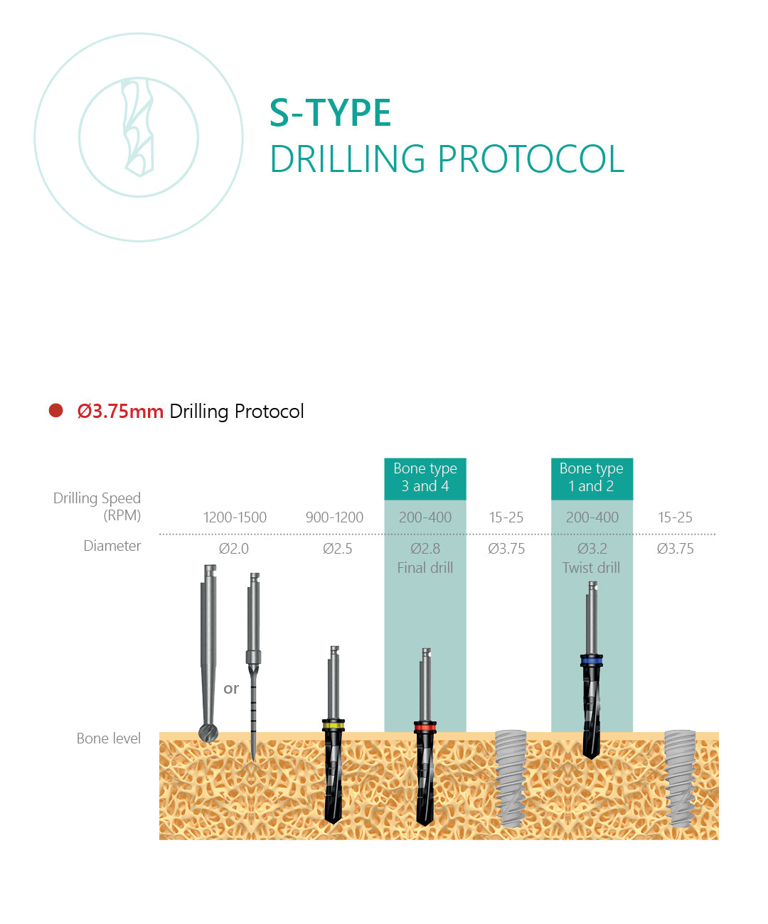 S-Type implant drilling protocol 3.75