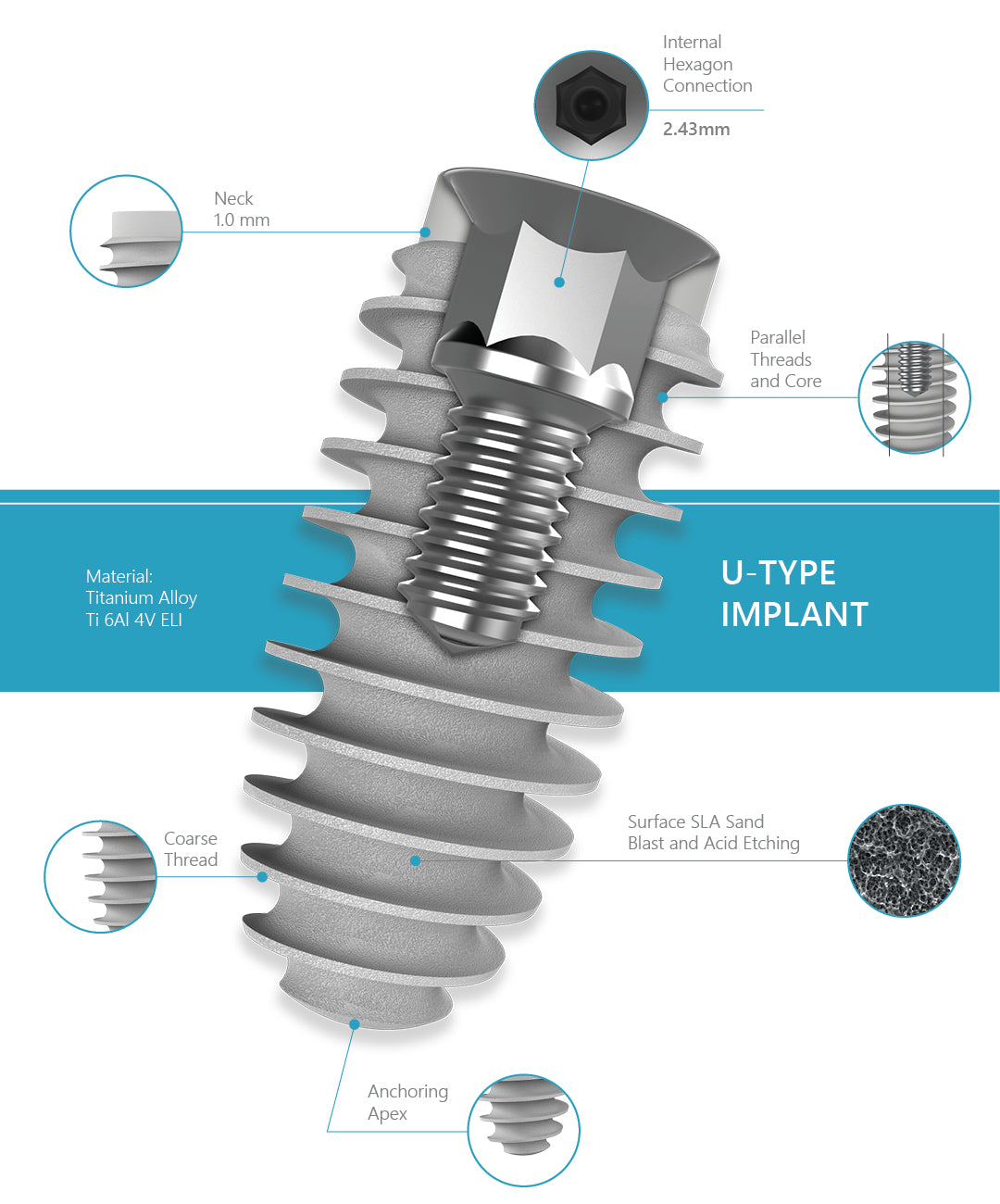 U-Type Dental Implant