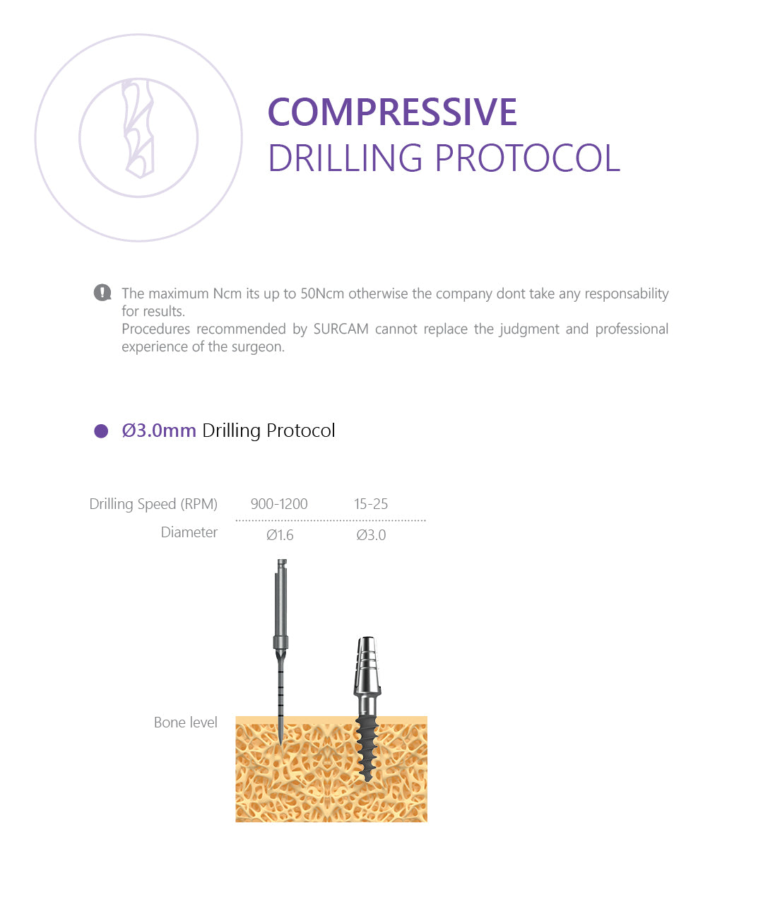 Compressive implant with bendable neck up to 30 degrees drilling protocol 3.0