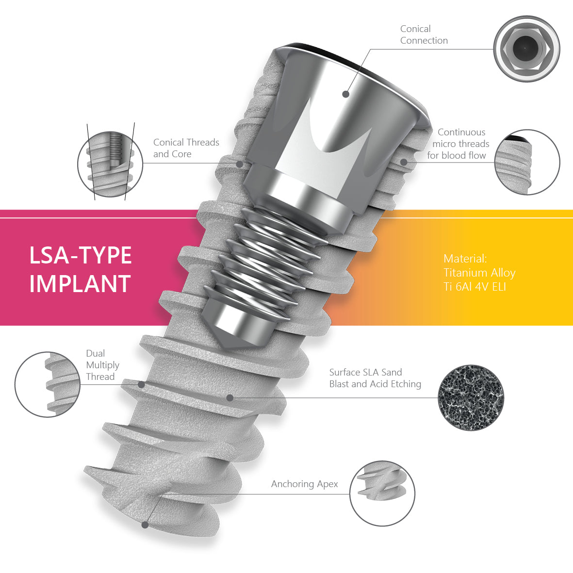 lsa-type implant features
