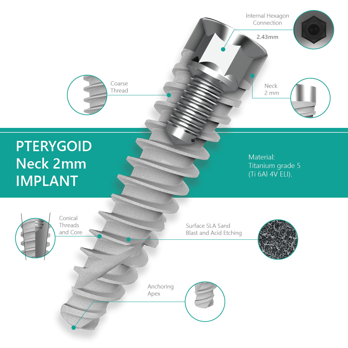 Pterygoid Implant Neck 2 mm